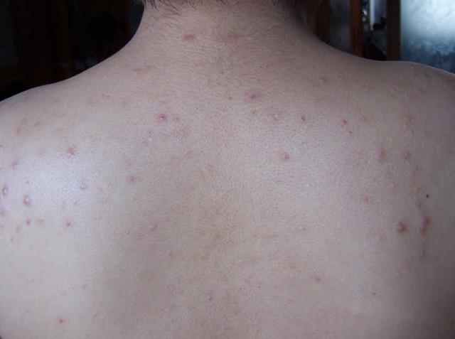 如何让男生变得看上去很干净、很清爽