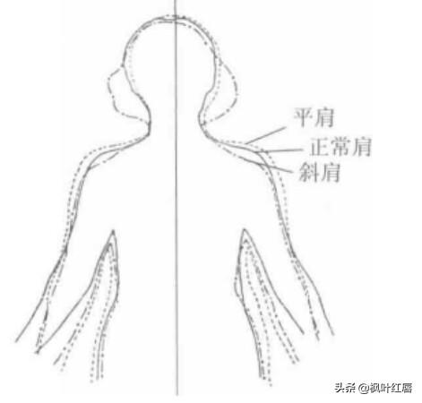 溜肩适合穿什么样袖子的旗袍,插肩的还是上袖的