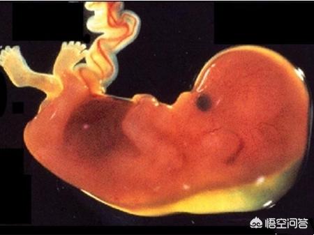 怀孕后NT、唐筛、无创、羊穿,孕妇该如何选择