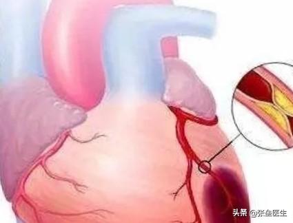 养生心经,心脏不好,应该在饮食注意什么哪些运动对可以锻炼心脏