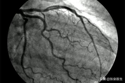 养生心经,心脏不好,应该在饮食注意什么哪些运动对可以锻炼心脏